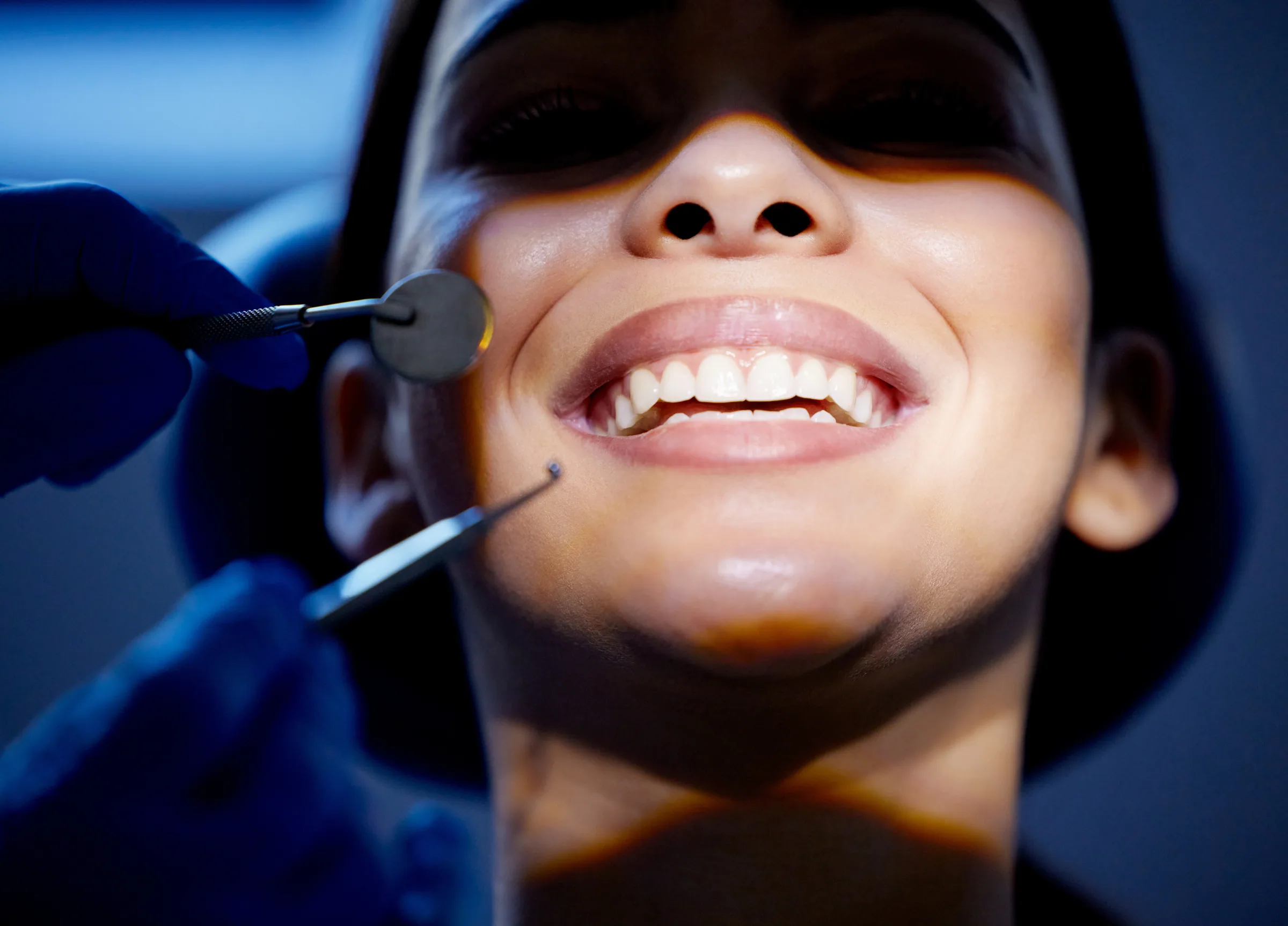Tooth Extraction